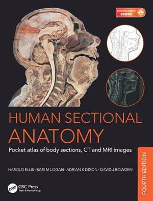 Human Sectional Anatomy: Pocket Atlas of Body Sections, CT and MRI Images, Fourth Edition by Adrian Kendal Dixon, David J. Bowden, Bari M. Logan