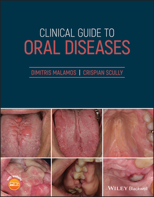 Clinical Guide to Oral Diseases by Crispian Scully, Dimitris Malamos