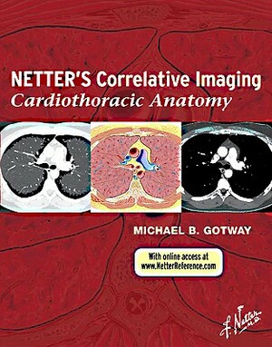 Netter's Correlative Imaging: Cardiothoracic Anatomy: With Online Access at Www.Netterreference.com by Michael B. Gotway