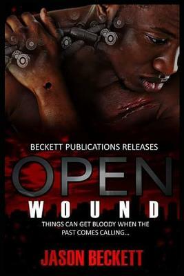 Open Wound 1 by Jason Beckett