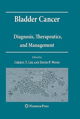 Bladder Cancer: Diagnosis, Therapeutics, and Management by 