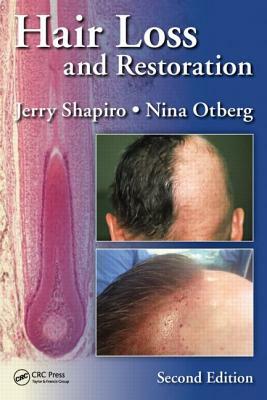 Hair Loss and Restoration by Jerry Shapiro, Nina Otberg