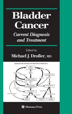 Bladder Cancer: Current Diagnosis and Treatment by 
