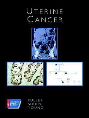 Uterine Cancer [With CDROM] by Michael Seiden, Robert Young, Arlan Fuller