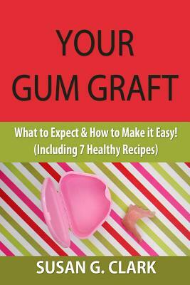 Your Gum Graft: What to Expect & How to Make it Easy! (Including 7 Healthy Recipes) by Susan G. Clark