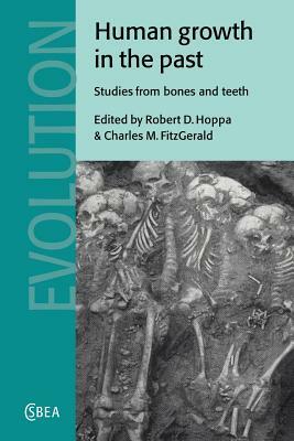 Human Growth in the Past: Studies from Bones and Teeth by 