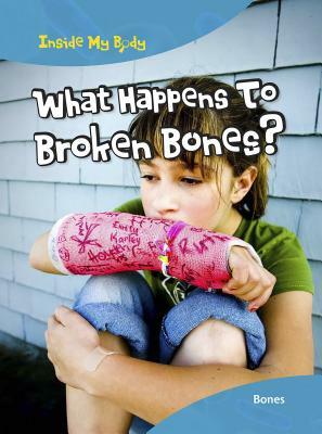 What Happens to Broken Bones?: Bones by Carol Ballard