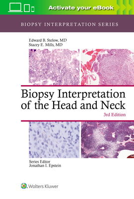 Biopsy Interpretation of the Head and Neck by Stacey Mills, Edward B. Stelow