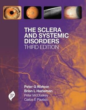 The Sclera and Systemic Disorders by Peter G. Watson, Brian L. Hazleman, Carlos E. Pavesio