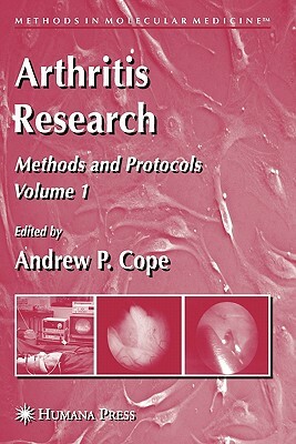 Arthritis Research: Volume 1: Methods and Protocols by 