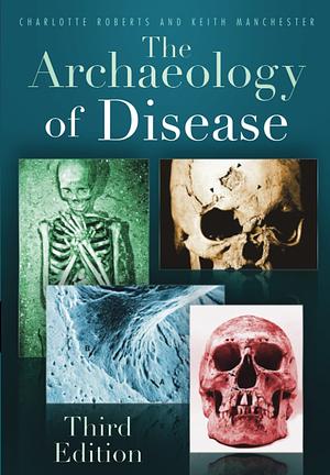 The Archaeology of Disease by Charlotte A. Roberts