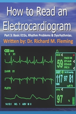 How to Read an Electrocardiogram - Part 3: Basic ECGs, Rhythm Problems & Dysrhythmias. by Richard M. Fleming