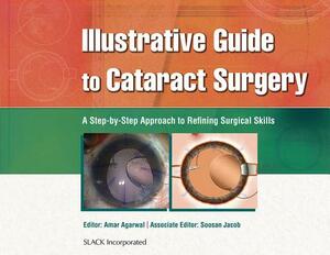 Illustrative Guide to Cataract Surgery: A Step-By-Step Approach to Refining Surgical Skills by Amar Agarwal