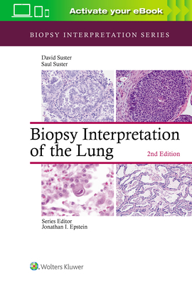 Biopsy Interpretation of the Lung by David Suster, Saul Suster