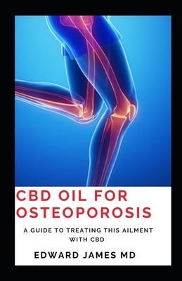 CBD Oil for Osteoporosis: A guide to treating this ailment with CBD by Edward James