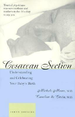 Cesarean Section: Understanding and Celebrating Your Baby's Birth by Caroline M. de Costa, Michele C. Moore