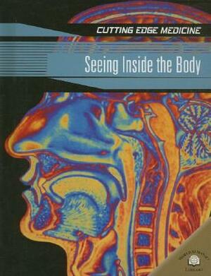 Seeing Inside the Body by Andrew Solway