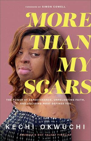 More Than My Scars: The Power of Perseverance, Unrelenting Faith, and Deciding What Defines You by Kechi Okwuchi, Kechi Okwuchi