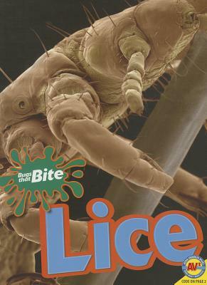 Lice by Pamela McDowell