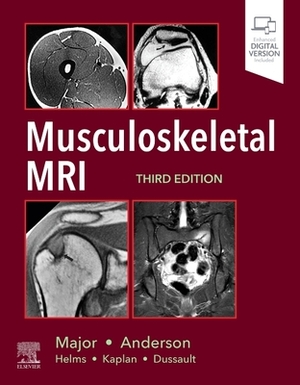 Musculoskeletal MRI by Mark W. Anderson, Mark W. Anderson, Nancy M. Major