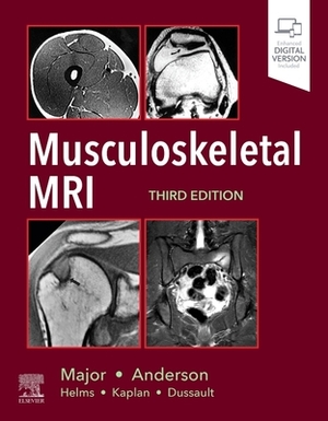 Musculoskeletal MRI by Nancy M. Major, Mark W. Anderson, Mark W. Anderson