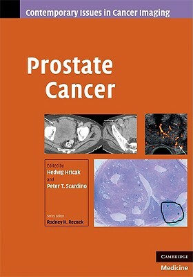 Prostate Cancer by 