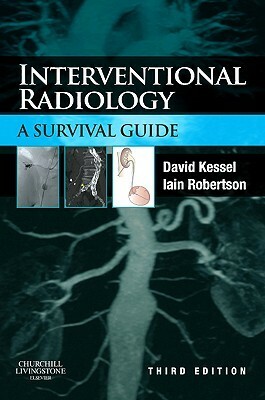Interventional Radiology: A Survival Guide by David Kessel