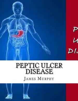 Peptic Ulcer Disease by James Murphy