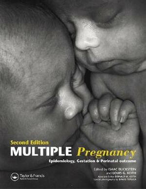 Multiple Pregnancy: Epidemiology, Gestation, and Perinatal Outcome by 