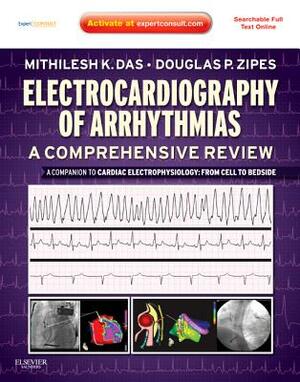 Electrocardiography of Arrhythmias: A Comprehensive Review: A Companion to Cardiac Electrophysiology by Douglas P. Zipes, Mithilesh Kumar Das