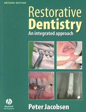 Restorative Dentistry 2e by Peter Jacobsen