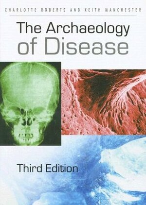 The Archaeology of Disease by Charlotte A. Roberts