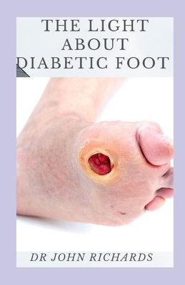 The Light About Diabetic Foot: Prevention, Treatment And Management Of Diabetic Foot by John Richards