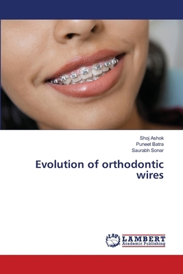 Evolution of orthodontic wires by Saurabh Sonar, Puneet Batra, Shoj Ashok