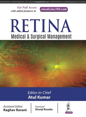 Retina by Atul Kumar