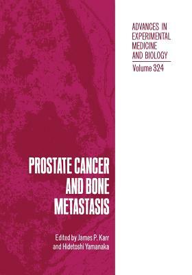 Prostate Cancer and Bone Metastasis by 