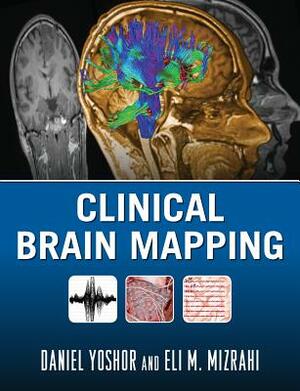 Clinical Brain Mapping by Eli Mizrahi, Daniel Yoshor