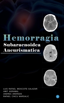 Hemorragia Subaracnoidea Aneurismatica by Amit Agrawal