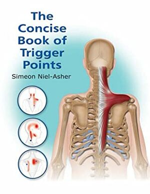The Concise Book of Trigger Points by Simeon Neil-Asher, Amanda Williams