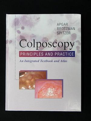 Colposcopy, Principles and Practice: An Integrated Textbook and Atlas by Mark Spitzer, Barbara S. Apgar, Gregory L. Brotzman
