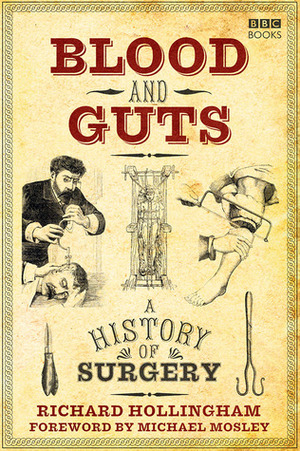 Blood and Guts: A History of Surgery by Richard Hollingham