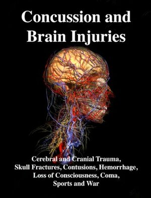 Concussion and Brain Injuries: Cerebral and Cranial Trauma,Skull Fractures, Contusions, Hemorrhage, Loss of Consciousness, Coma, Sports and War by Joseph Gabriel