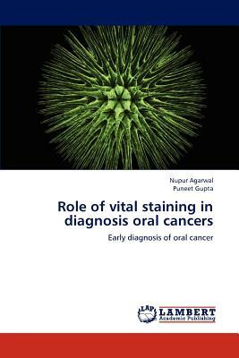 Role of Vital Staining in Diagnosis Oral Cancers by Nupur Agarwal, Puneet Gupta