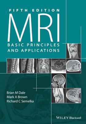 MRI: Basic Principles and Applications by Brian M. Dale, Richard C. Semelka, Mark A. Brown