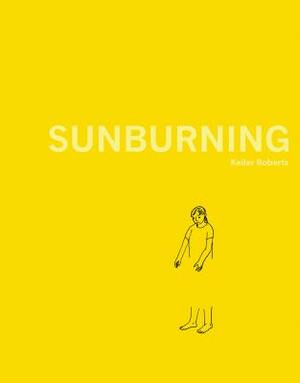 Sunburning by Keiler Roberts