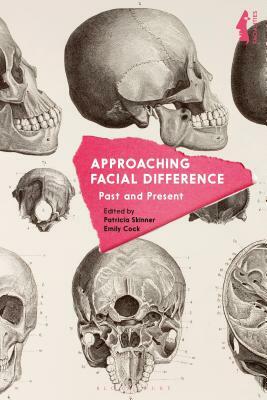 Approaching Facial Difference: Past and Present by Emily Cock, Patricia E. Skinner