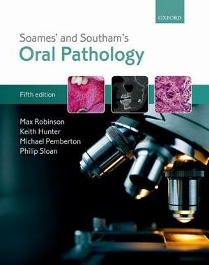 Soames' & Southam's Oral Pathology by Keith Hunter, Max Robinson, Michael Pemberton