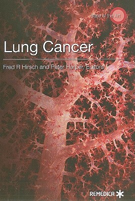 Lung Cancer by Peter Harper, Fred R. Hirsch