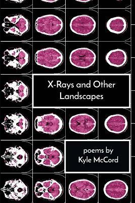 X-Rays and Other Landscapes by Kyle McCord