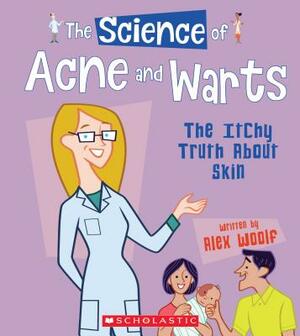 The Science of Acne and Warts: The Itchy Truth about Skin (the Science of the Body) by Alex Woolf